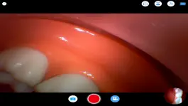 Game screenshot minimirror oral endosope apk