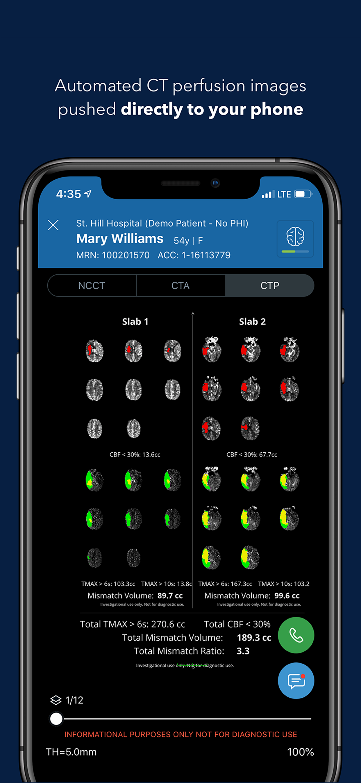 Viz Training AI Stroke Care