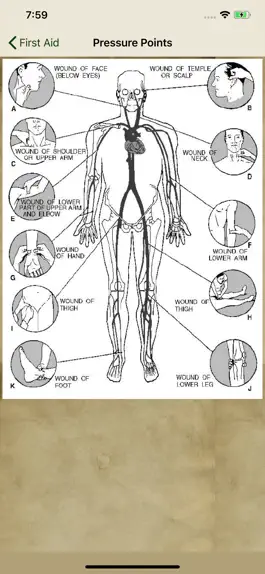 Game screenshot Wilderness First Aid apk