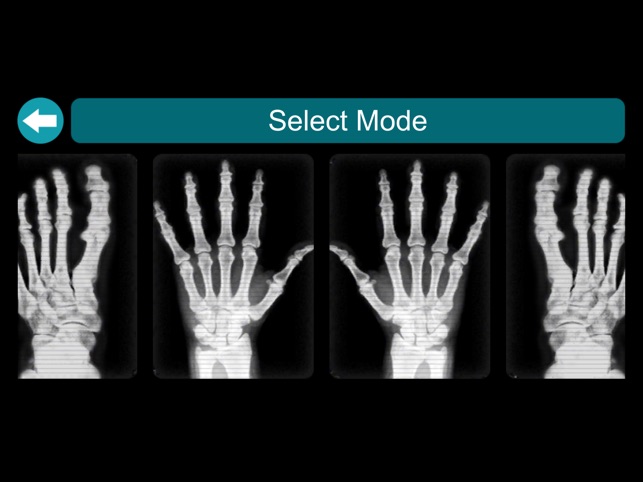 XRay Scanner – Part of Body Scanner Simulator::Appstore