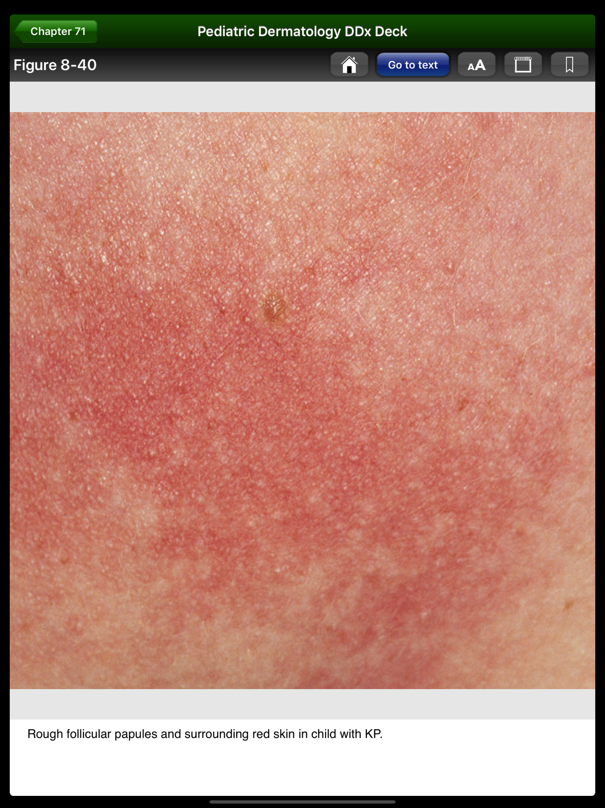 Pediatric Dermatology DDx Deck screenshot 9