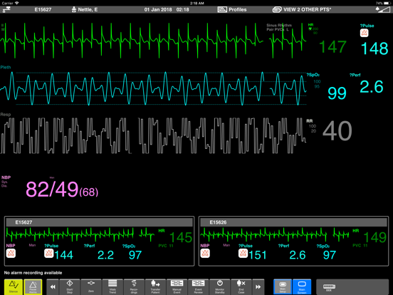 Screenshot #4 pour Elle's Monitor