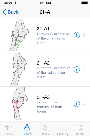 AO/OTA Fracture Classificationのおすすめ画像2