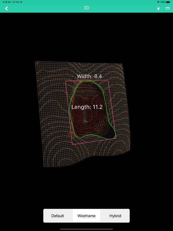 Parable iPad screenshot 7 - Medical app
