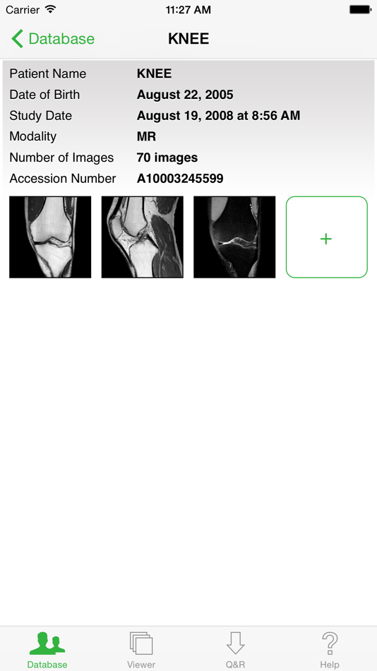 #4. OsiriX HD (iOS) 由: Pixmeo SARL