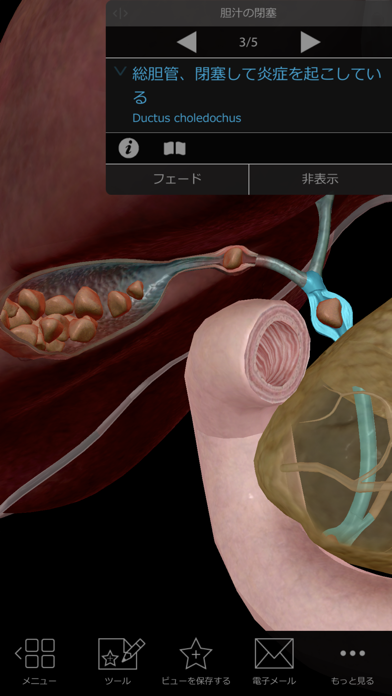 生理学と病理学スクリーンショット