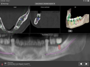 coDiagnostiX app screenshot 2
