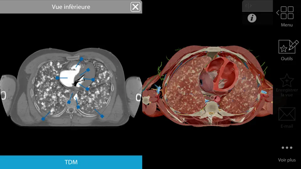 Capture d'écran de Physiologie & Pathologie sur iPhone 9