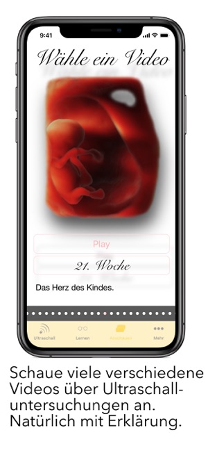 Scanbaby Ultraschall Fur Mamas Im App Store