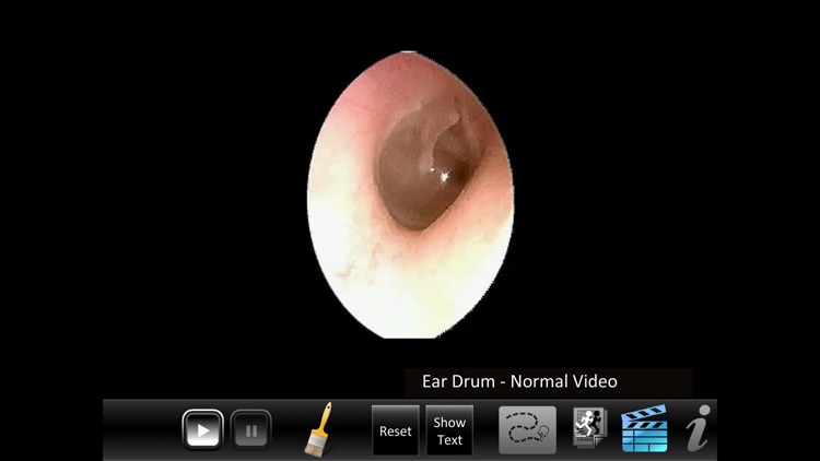 Ear ID screenshot-3