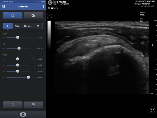 Screenshot #5 pour SONON Ultrasound App