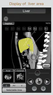 ct passport abdomen iphone screenshot 3