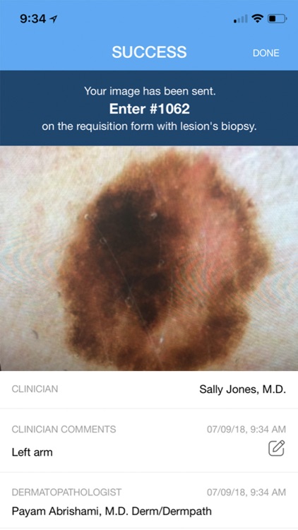 DermPic - Dermoscopy