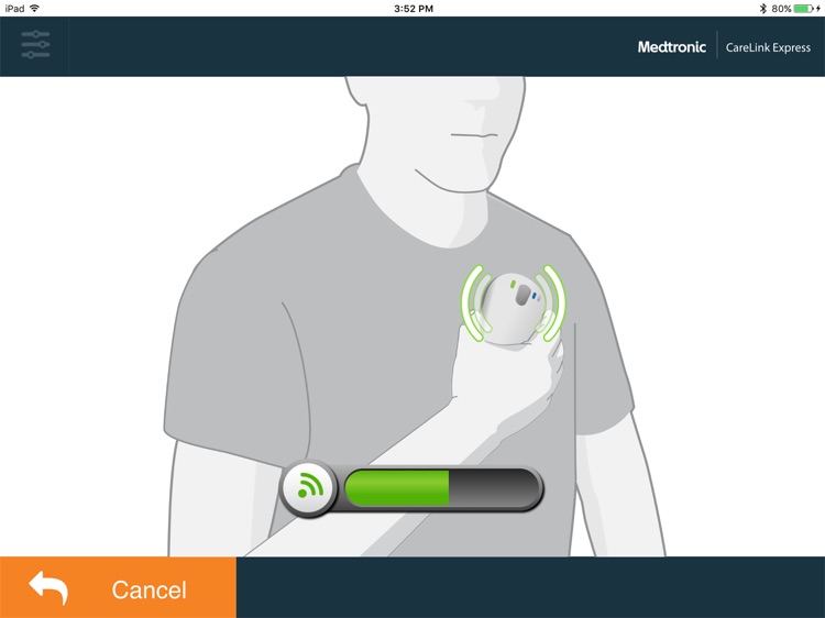 CareLink Express™ Mobile CAR