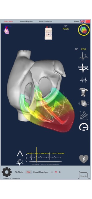 Intelligent Heart Sim AFib(圖3)-速報App