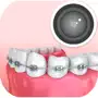 Braces Camera