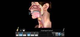 Game screenshot Laryngectomy apk
