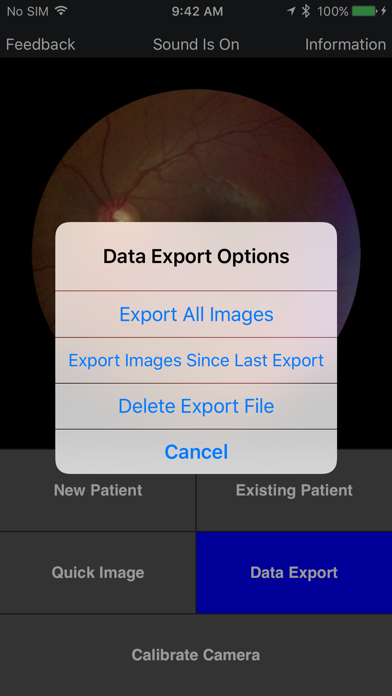 Volk iNview iPhone screenshot 5 - Medical app