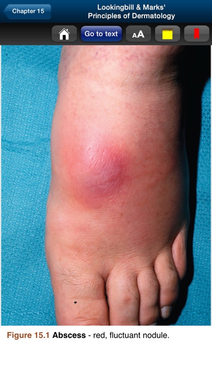 Lookingbill & Marks' Derm. 5E screenshot-3