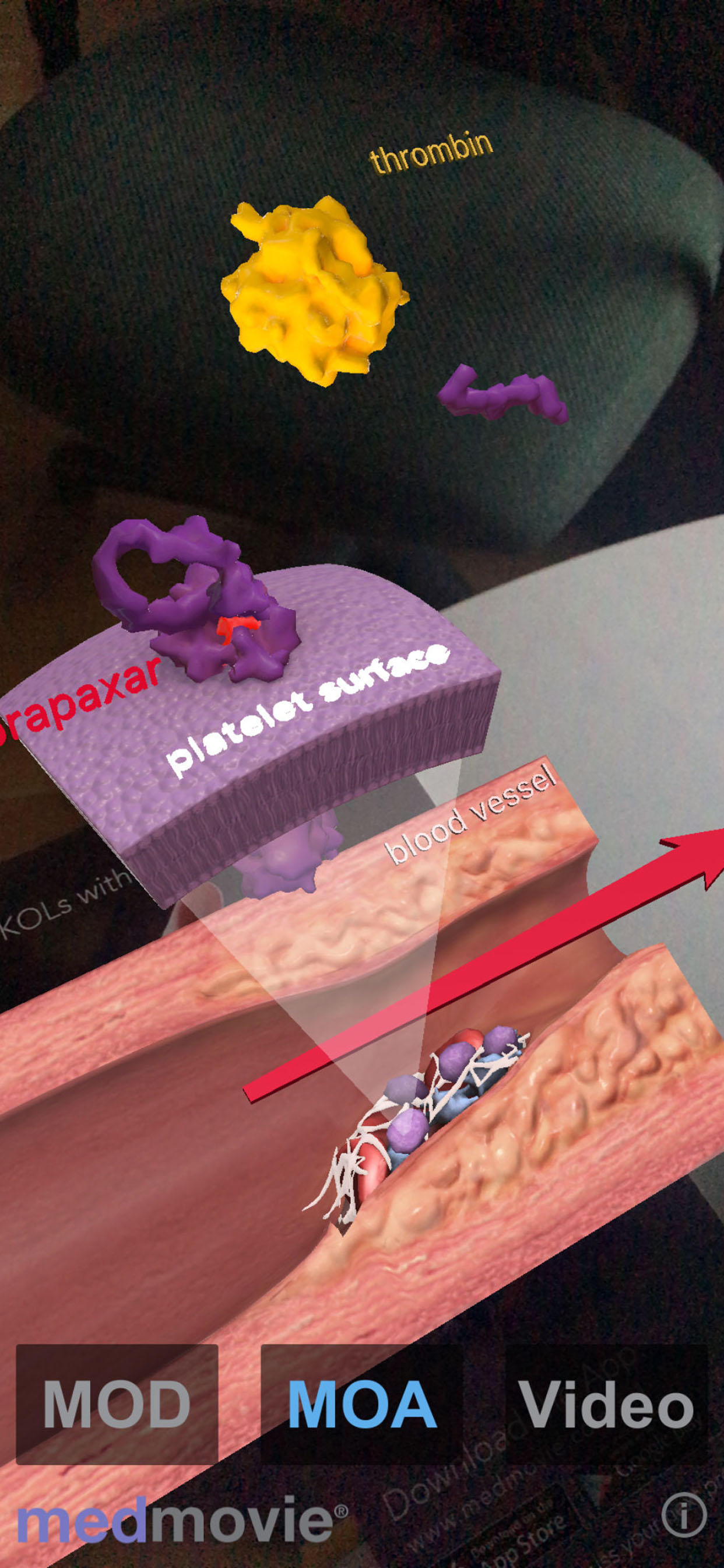 Medmovie AR1