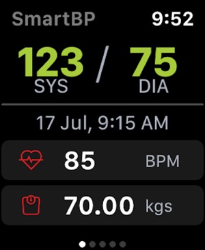 123 75 la presión arterial está bien 123 75 la presión arterial está bien