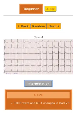 Game screenshot Pocket ECG apk