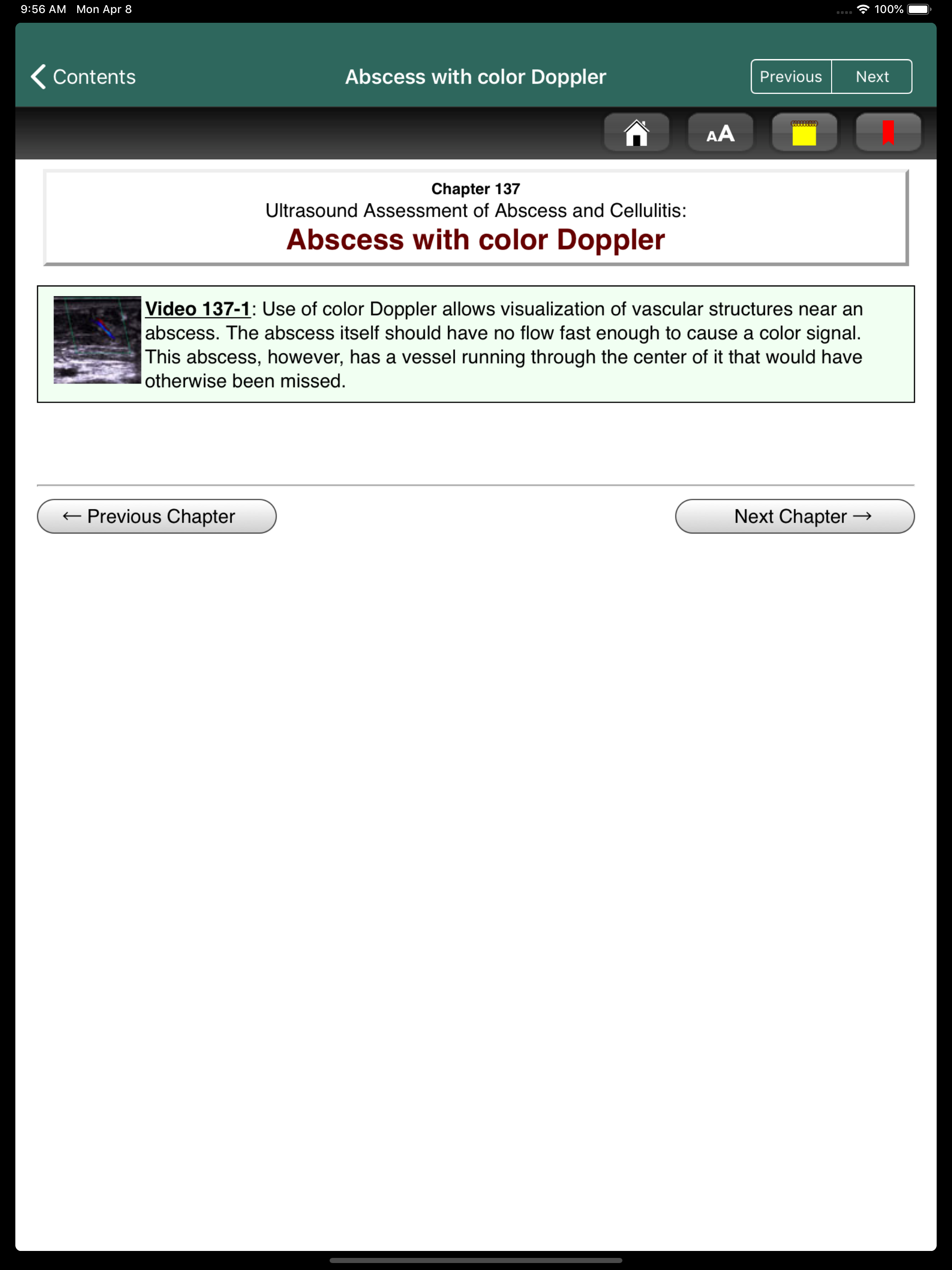 Videos for POCUS: Ultrasound screenshot 9