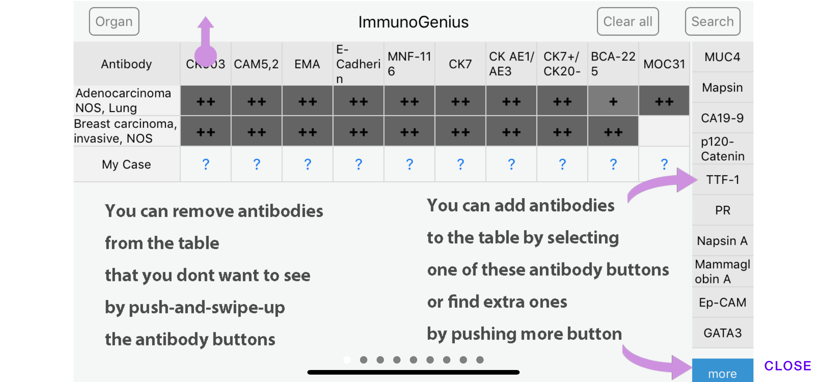 ImmunoGenius