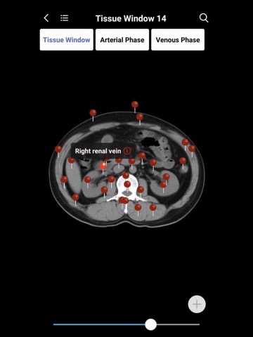 MedImaging-Radiology Made Easyのおすすめ画像8