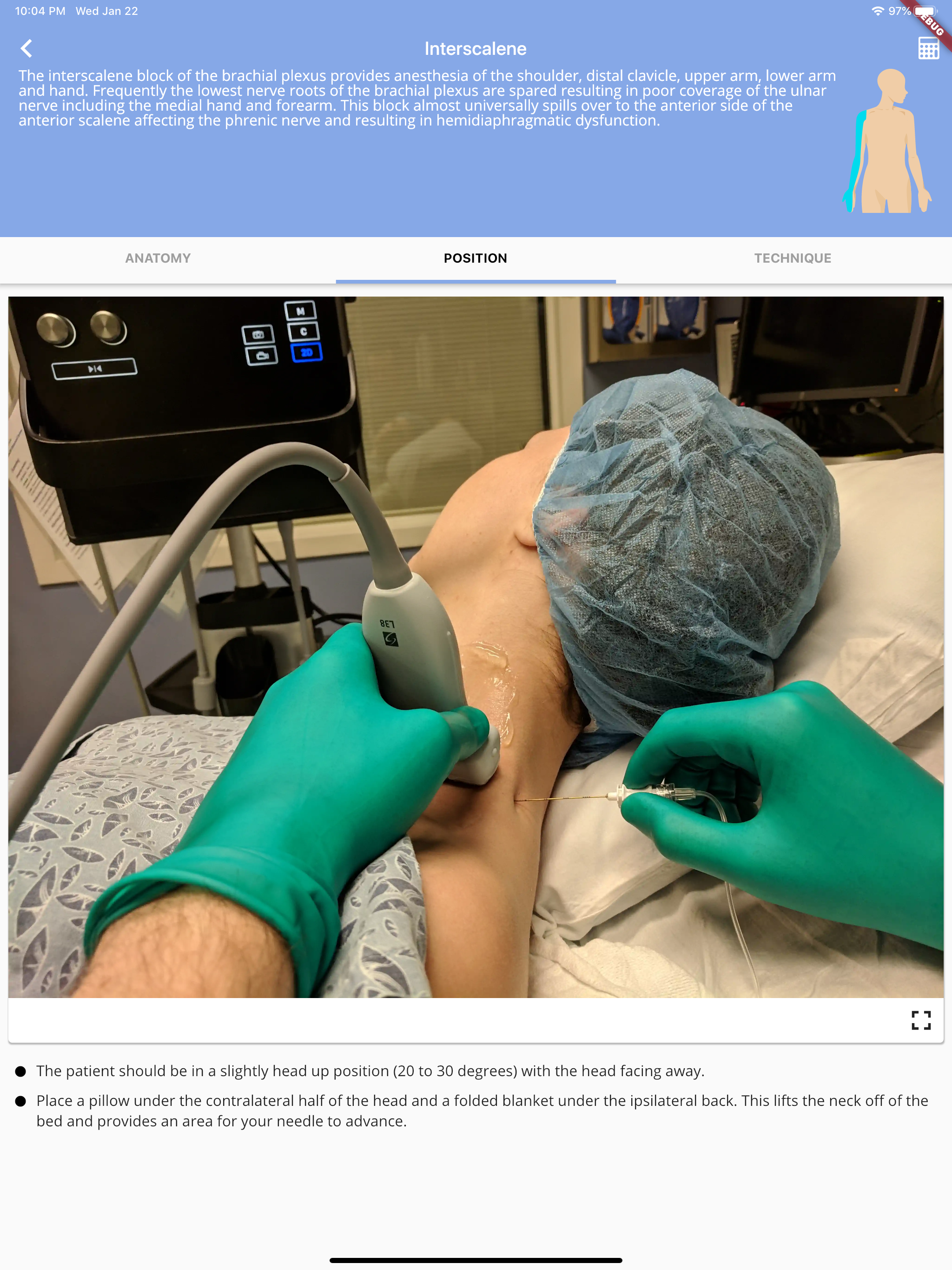 Regional Anesthesia Reference