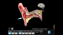 Game screenshot Ear Disorders: Outer Middle mod apk