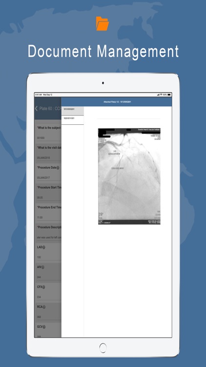 DFcollect screenshot-4