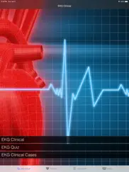 ekg clinical ipad resimleri 1