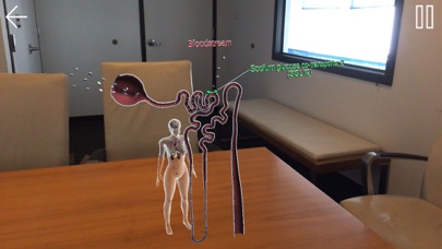 SGLT2 & GLP-1 in Diabetes screenshot 2