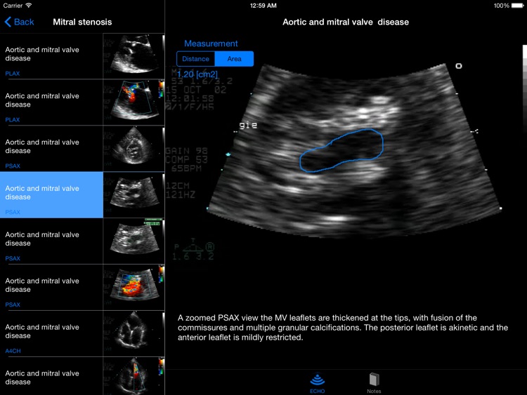 CARDIO3®Echocardiography HD screenshot-4
