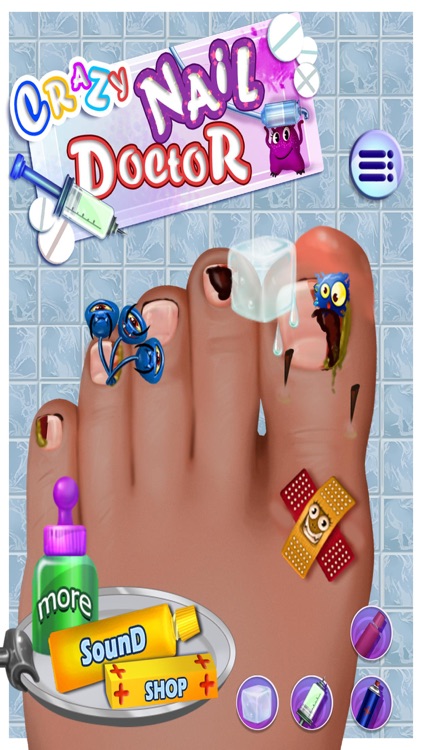 Crazy Toe Nail Doctor Surgery