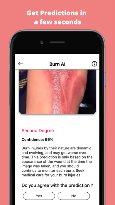 Screenshot #3 pour Burn AI