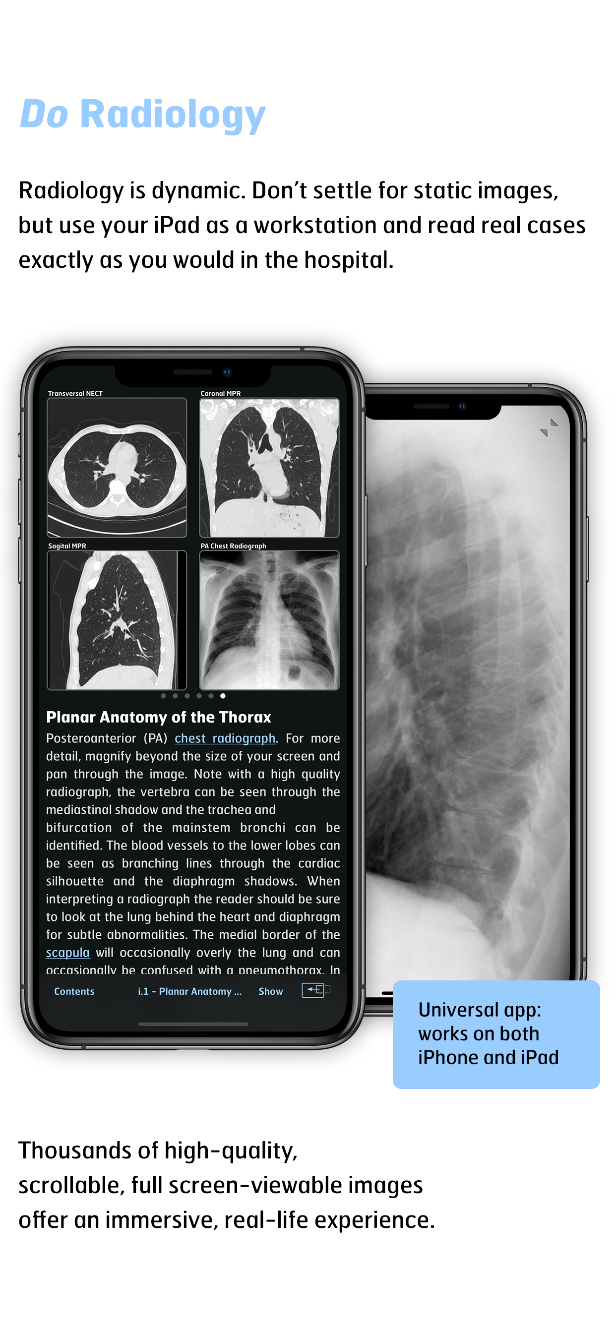 Radiology - Thoracic Imaging screenshot 4