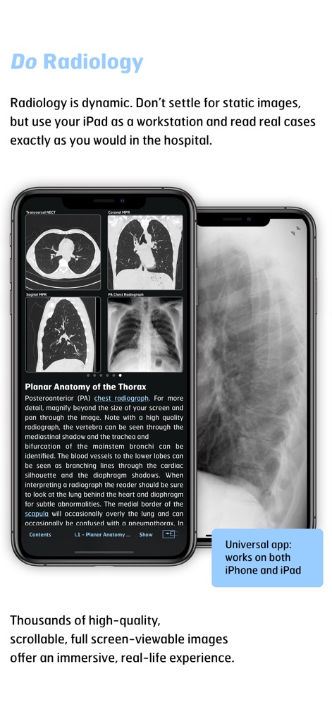 Radiology - Thoracic Imaging - App de Medicina | MWM