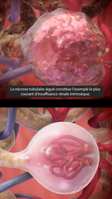 Screenshot #3 pour Physiologie & Pathologie