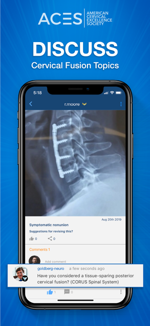 ACES – Cervical Fusion Forum(圖2)-速報App