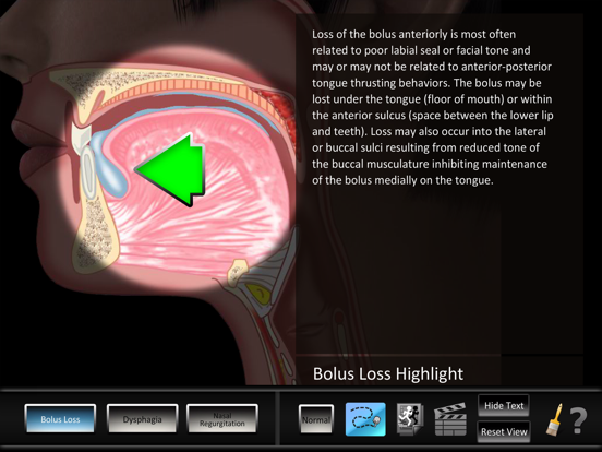 Screenshot #5 pour Oral Disorders