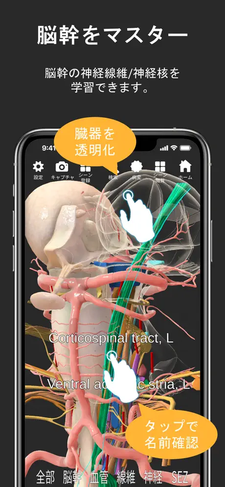 脳観