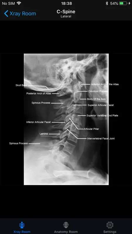 iRad Xrays screenshot 3 of 4