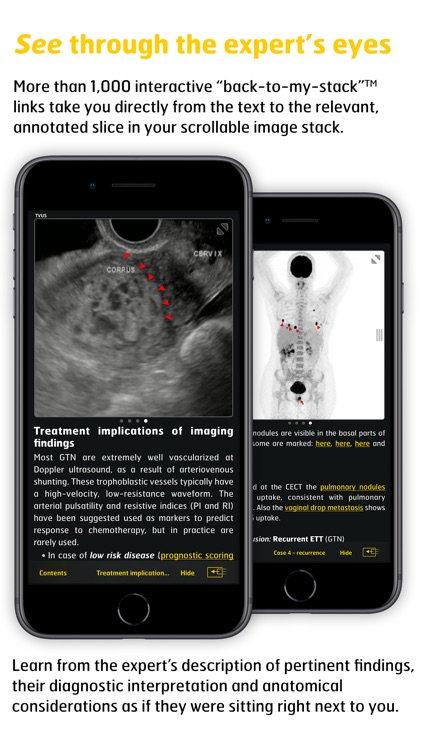 Gyn Cancer Staging Atlas screenshot-3