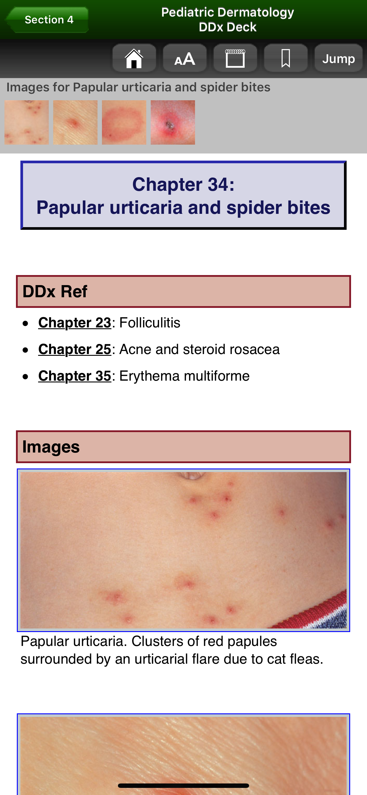 Pediatric Dermatology DDx Deck screenshot 3