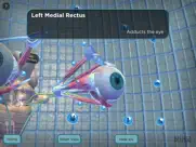 the extraocular muscles iPad Captures Décran 3