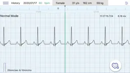 Game screenshot Q-ecg apk
