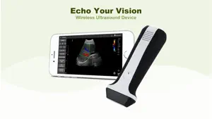 LELTEK Ultrasound - LeSono screenshot 1