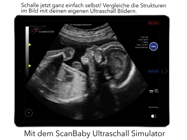 Scanbaby Ultraschall Fur Mamas Im App Store